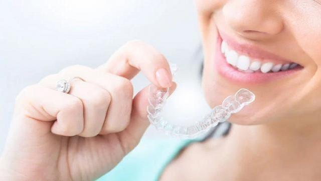 Alineadores invisibles: la nueva revolución en estética dental